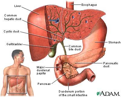 liver gallbladder stones. treatment of gall stones